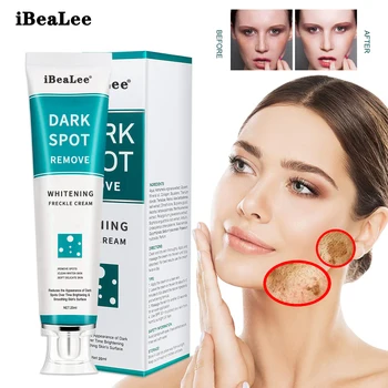 10PCS Učinkovito Beljenje Freckle Kremo Odstranite Melasma Acne Spot Pigment Melanin Temne Lise Pigmentacije Vlažilno Nego Kože